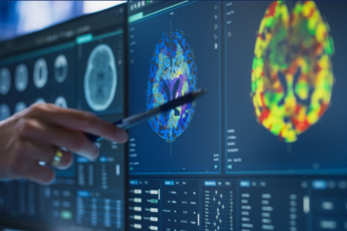 Rugby risques cérébraux : l'étude choc qui alerte sur les maladies neurodégénératives