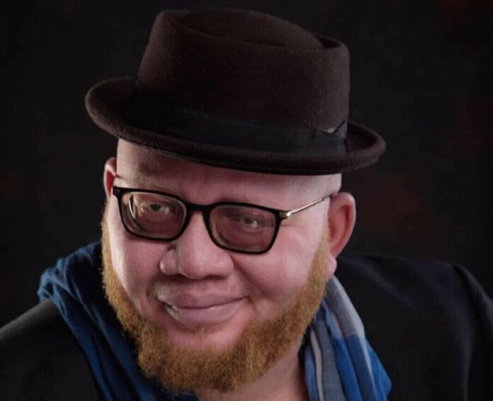 Albinisme RDC : Yan Mambo célèbre 10 ans de combat avec « Fièrement Ndundu »